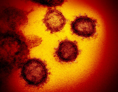 An electron micrograph of the Covid-19 virus.